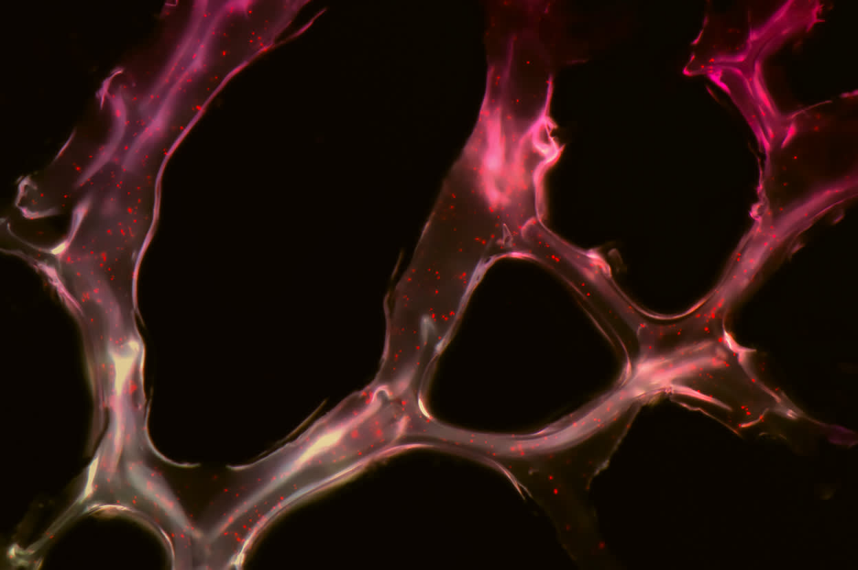 A microscopic view into brain anatomy with inverted blacks, meant to showcase neurological disorders as a result of poor mouth health – Viome Oral Health Intelligence Test 